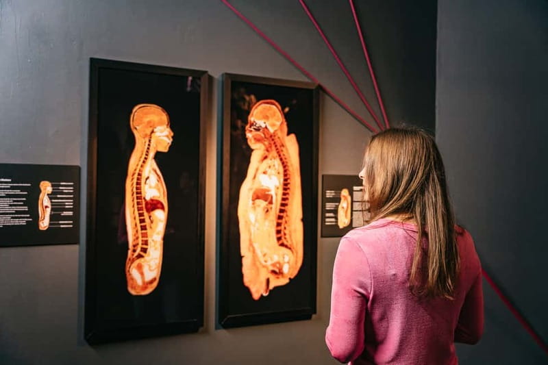 Berlin: Tickets for the BODY WORLDS Museum in Berlin - What to expect from the crowd, and how to keep the mood respectful
